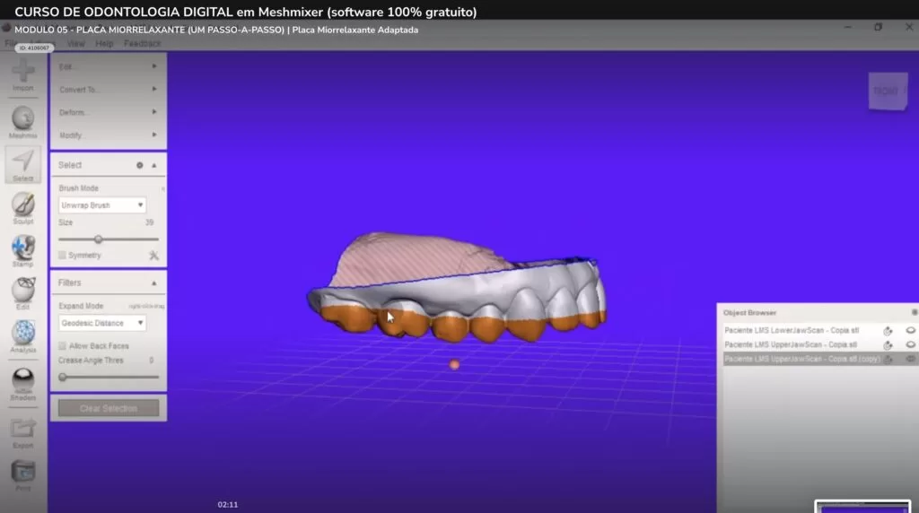 Curso de Odontología Digital en Meshmixer Placa Miorrelajante Digital Odonto