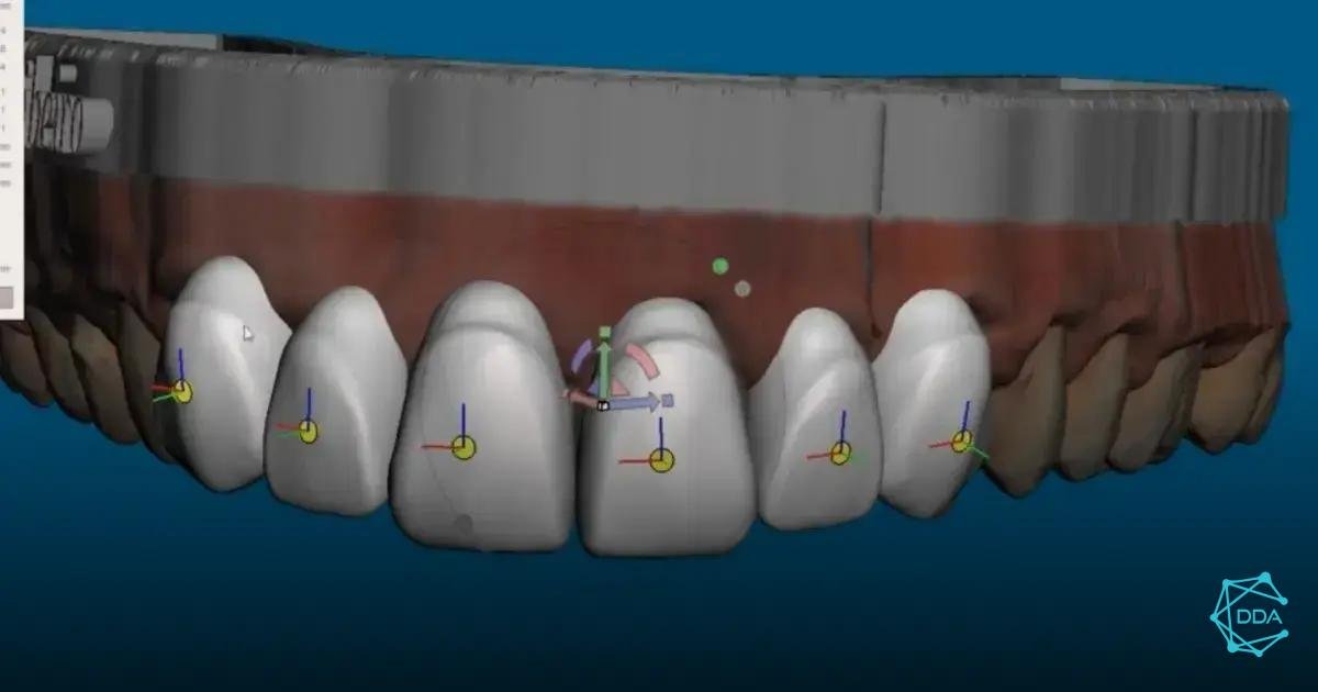 Realinhamento e Edição de Dados do Medit Scan