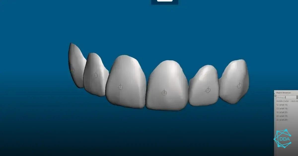 Alinhamento com o Aplicativo Medit Splints