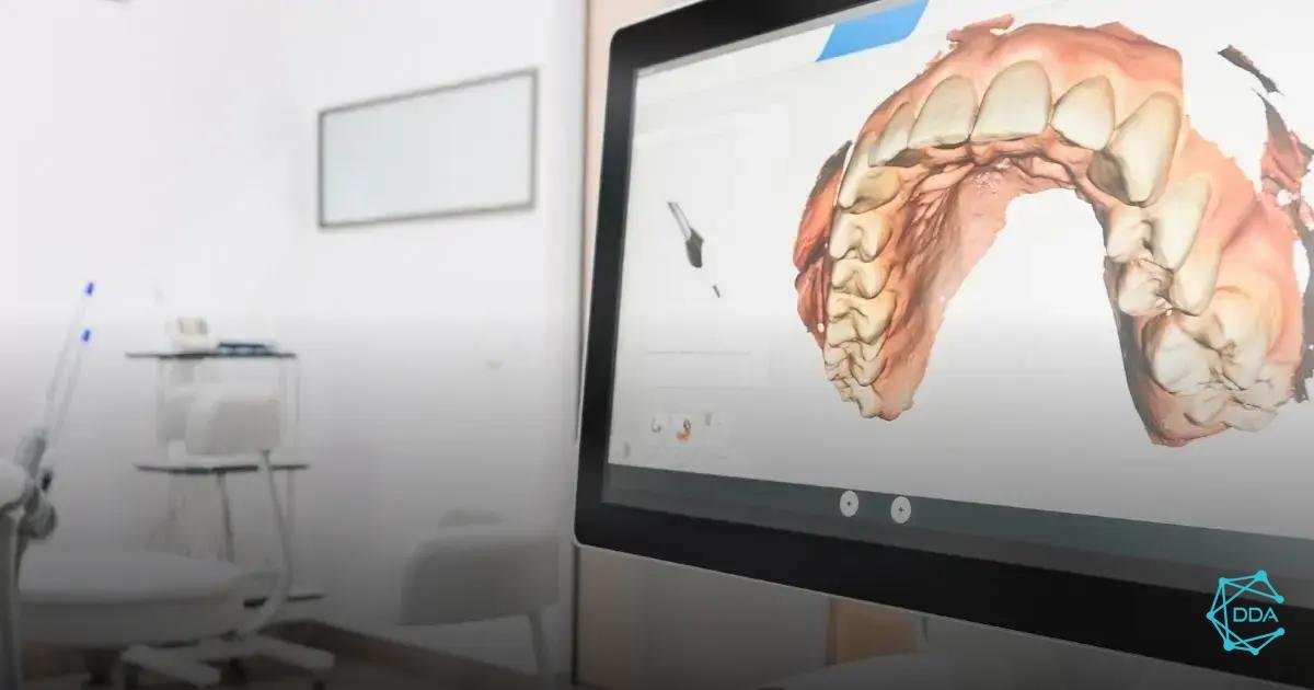 Disadvantages of Intraoral Scanning