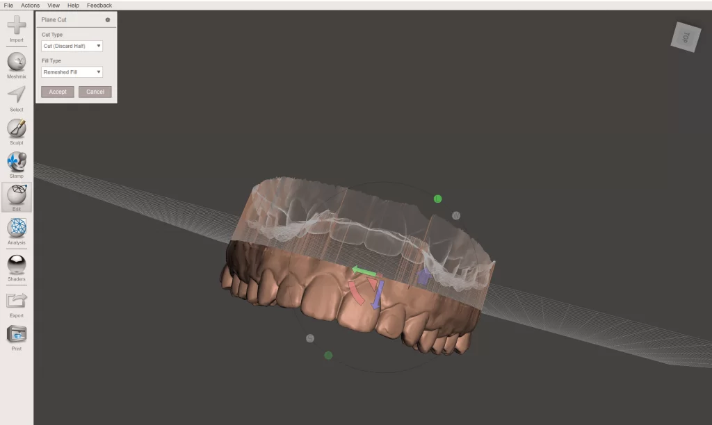 Getting Started in Digital Dentistry with the Meshmixer Software