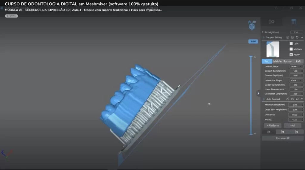 3D Printing Tips in Digital Dentistry