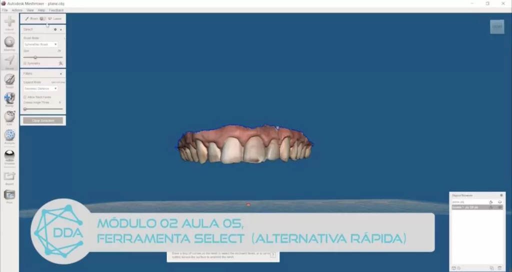 Meshmixer en odontología: ¡descárguelo y aprenda a usarlo ahora!