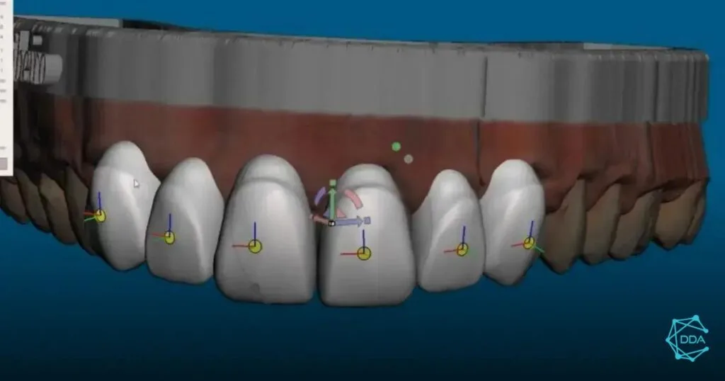 5 Dicas Práticas para Usar Impressoras 3D na Odontologia