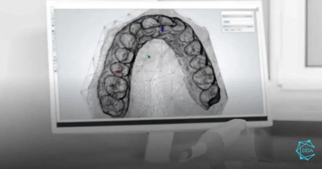 5 Essential Steps for Implant Planning with NobelClinician