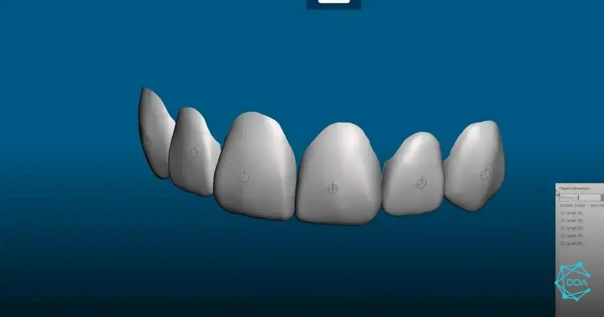 Alinhamento com o Aplicativo Medit Splints
