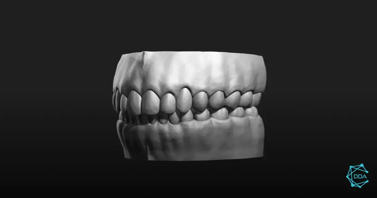 Impressão 3D na Odontologia