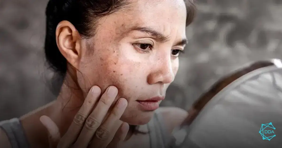 Differences between Botox and Fillers